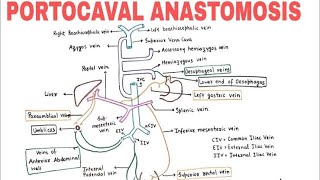 Portocaval Anastomosis  Shunts  Pathology  Clinical amp Non Clinical Importance  Cirrhosis [upl. by Sema]