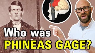 The Remarkable Tale of Phineas Gage [upl. by Ahtoelc]