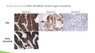 Webinar New Tool for Antibody Specificity Testing [upl. by Airyt409]