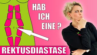 5 💜Anzeichen einer Rektusdiastase💜Wie erkenne ich ob ich eine Rectusdiastase habe💜habe ich eine💜 [upl. by Swerdna]