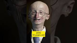 The evolution of Sam Berns [upl. by Conrado]