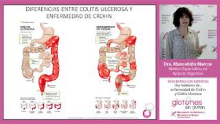 Enfermedad Celiaca Enfermedad de Crohn y Colitis Ulcerosa [upl. by Ailemor]