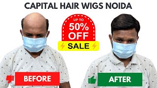 Hair treatment for hair loss  Hairfall solution  Hair wig for men  Wigs  Call 9643765000 [upl. by Sherj]