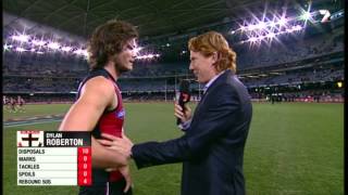 Hit leaves Roberton confused  AFL [upl. by Eneluqcaj]