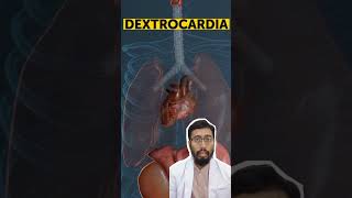 Jantung terbalik Apakah normal dextrocardia situsinversus youtubehealth [upl. by Asaeret]