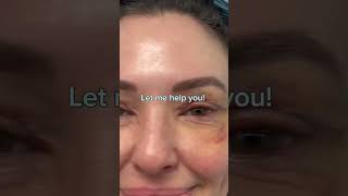 THINKING ABOUT GETTING PLASTIC SURGERY  DR TANVEER JANJUA  NEW JERSEY [upl. by Eeroc]