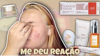 PAREI DE USAR A SUAVICID  MEU MELASMA VOLTOU  Ket Brinhol ✨ [upl. by Blair557]