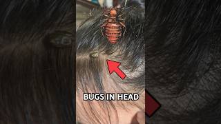 Insects in girl head 😳 [upl. by Gilbye561]