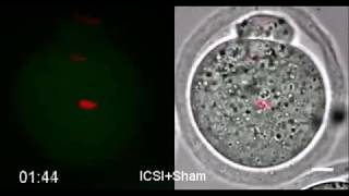 Single nucleolus precursor body formation in the pronucleus of mouse zygotes and SCNT embryos [upl. by Ainessej]