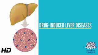 DrugInduced Liver Disease Causes Signs and Symptoms Diagnosis and Treatment [upl. by Hoskinson183]