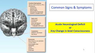 A patient with sudden onset slurring of speech with limb weakness HD WEB [upl. by Lull52]