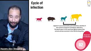 Brucellosis [upl. by Darlene]