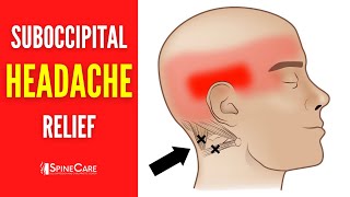 How to Release Tight Suboccipital Muscles  HEADACHE RELIEF in Seconds [upl. by Sset]