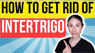 How To Get Rid Of Intertrigo FAST  Dermatologist Tips [upl. by Meli]