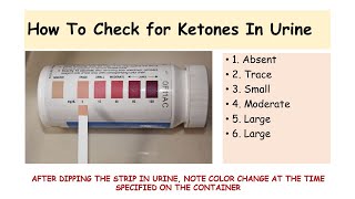 Urine Ketone Testing Technique [upl. by Philly970]