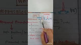 Hypertension in Pregnancy Pregnancy induced Hypertensionusmle usmlestep2ck eclampsia step2 [upl. by Sirc493]