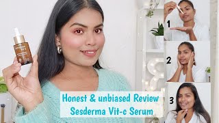 Most Honest review SESDERMA vitC serum A products that has changed my skin  liposomal Vitc Serum [upl. by Nnylsor]