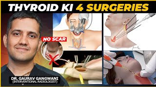 My Reaction To Different Types of Minimally Invesive Thyroid Surgeries  Dr Gaurav Gangwani IR [upl. by Atsuj]