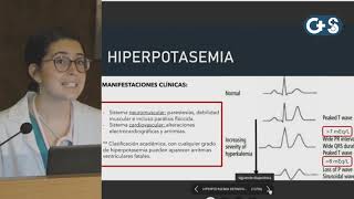 Sesión clínica Potasio como tratarlo hoy Hiperpotasemia [upl. by Persian536]