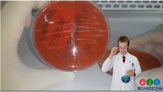 Urocultura  Entenda como interpretar o crescimento bacteriano em placas de ágar sangue 2ª parte [upl. by Aerda732]