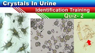 Crystals In Urine Identification Training Quiz  Part 25 [upl. by Eenitsed]