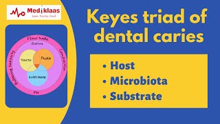 Keyes Triad of Dental caries l Pediatric and Preventive Dentistry l Mediklaas [upl. by Arahsak]