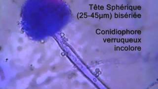 Aspergillus flavus explained [upl. by Hasin218]