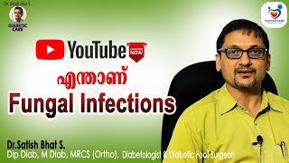 എന്താണ് Fungal Infections DrSatish Bhat SDiabetic Care  Malayalam Health Tips [upl. by Beane]