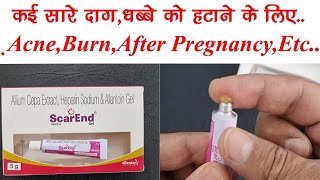 ScarEnd Gel BenefitsDosageSide Effect  दागधब्बे हटाने के लिए  Allium CepaHeparinAllantoin [upl. by Choong]