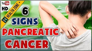 6 Early Signs of Pancreatic Cancer  Symptom of Pancreatic Cancer [upl. by Boyt]