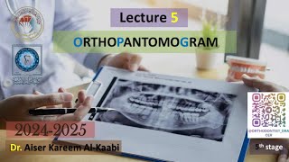 Orthopantomogram OPG lecture 5 2025 [upl. by Nanek]