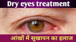 cmc eye drop used in hindi  tears top eye drop used in hindi  Tear Drops Eye Drops Uses in Hindi [upl. by Ahsielat]