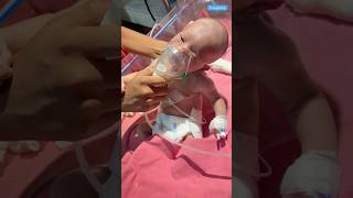 Nebuliser newbornbaby medical viralshort [upl. by Mauer847]