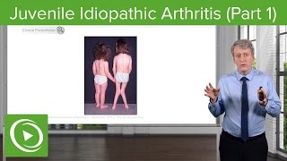 Juvenile Idiopathic Arthritis JIA Pathology amp Clinical Presentation – Pediatrics  Lecturio [upl. by Athenian631]