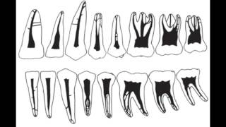 Anatomia dental Caninos temporales [upl. by Althee]