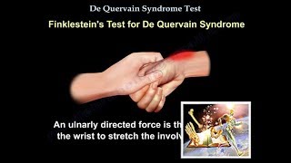 De Quervain Syndrome Test  Everything You Need To Know  Dr Nabil Ebraheim [upl. by Marcy]