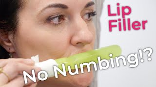 Lip Filler Without Numbing [upl. by Pliner211]