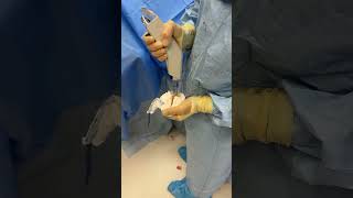 Orthopedic surgery operationtheatre operationtheatretechnician orthopedics shorts [upl. by Einnus]