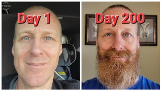 200 Days Of Beard Growth  Time Lapse [upl. by Agnimod471]