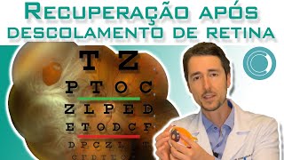 Recuperação da visão após cirurgia para descolamento de retina [upl. by Atir]