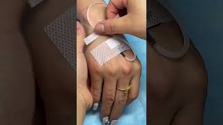 IV INSERTION MATHOD 💉🩺health ivinfusion viral hospital shorts [upl. by Onahpets]