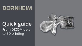 quick guide  From DICOM data to 3D printing [upl. by Piderit]