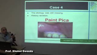 3rd esnt Interstitial nephritis Prof Khaled Eweeda [upl. by Surat948]