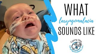 What Laryngomalacia Sounds Like  noisy breathing  newborn congestion [upl. by Bowne134]