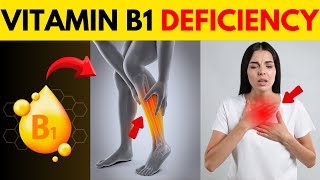 7 Unusual Vitamin B1 Deficiency Symptoms Thiamine [upl. by Aenit]