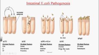 Enterobacteriaceae  Escherichia coli  Klebsiella pneumoniaemp4 [upl. by Madonia]