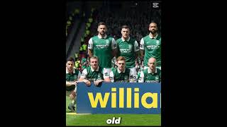 Hibs team vs old Hibs team 😢 hibs scottishcup spfl [upl. by O'Neill286]