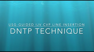 CVP line Insertion using DNTP technique Ultrasound guided central line insertion [upl. by Ayhtak]