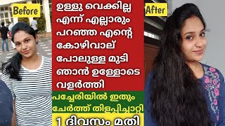 😱ഡോക്ടർ പറഞ്ഞപ്പോൾ ഇത്രക്ക് result കിട്ടും വിചാരിച്ചില്ല 💯Extreme hairgrowth spray hairgrowth [upl. by Nylaroc642]