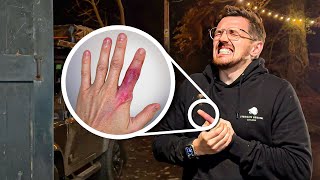 Things didn’t go to plan… I Broke my Finger ⛑️ [upl. by Normac]